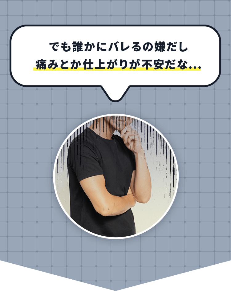 でも誰かにバレるの嫌だし 痛みとか仕上がりが不安だな...