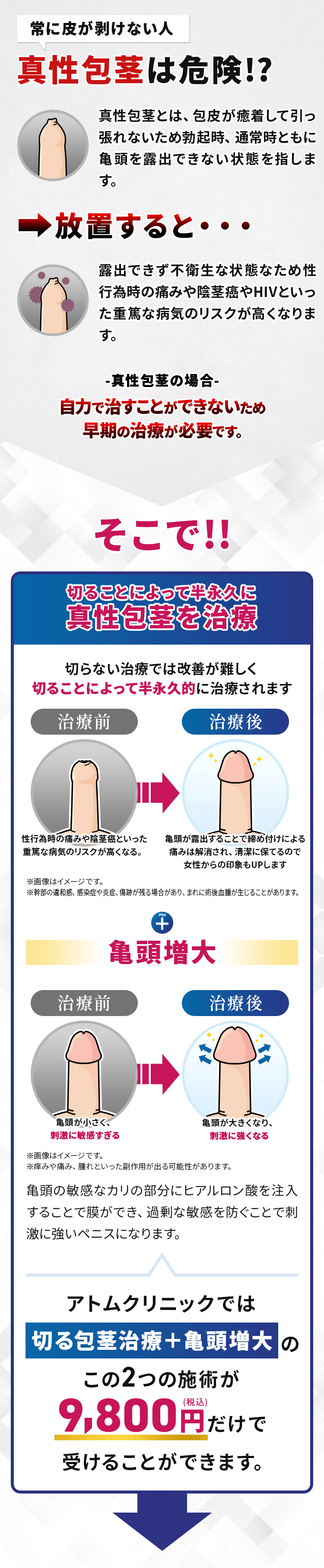 真性包茎は危険!?