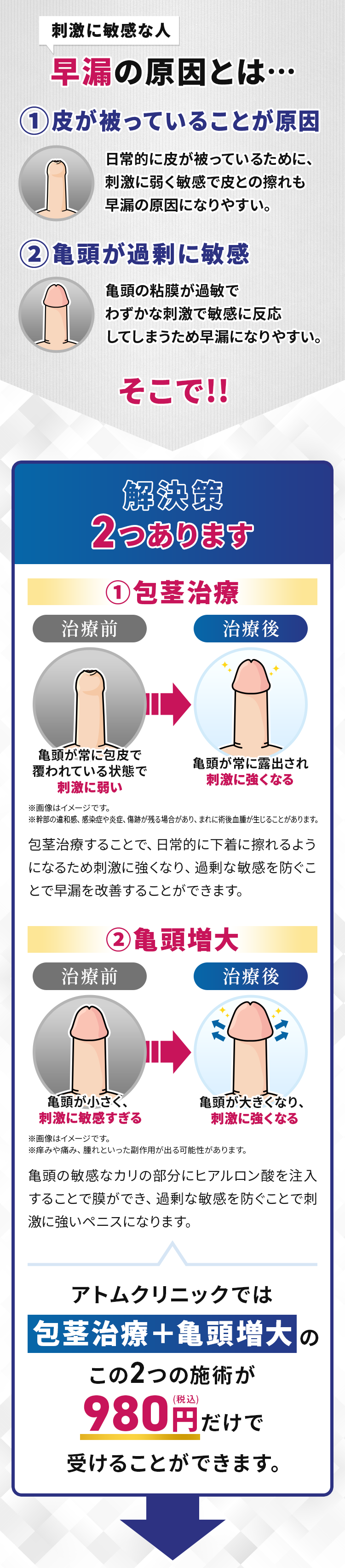 早漏の原因とは